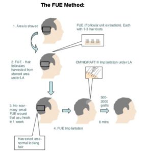 the-fue-method-image
